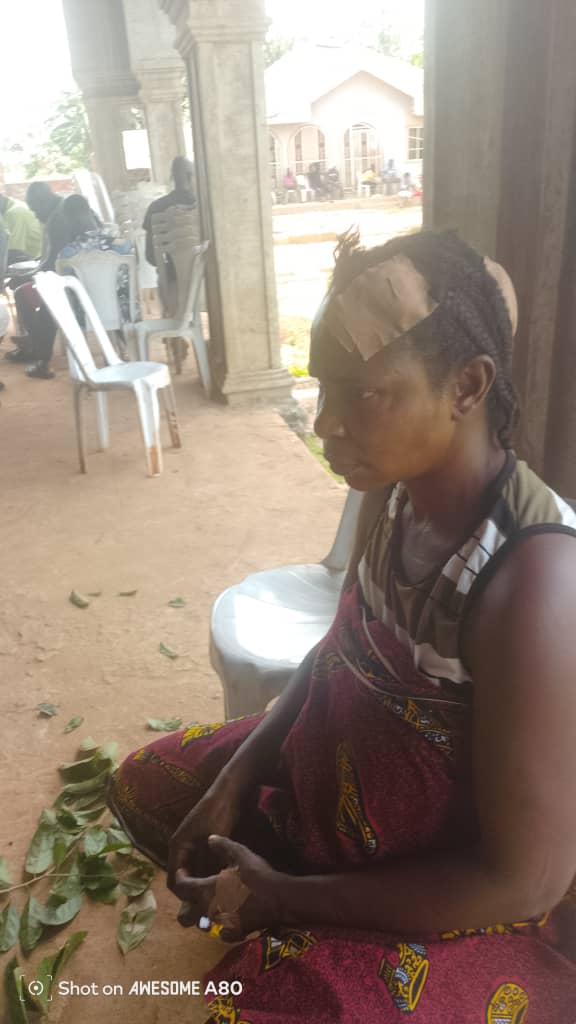 Police Brutality: Oriozolua Residents Appeal to Gov. Okpebholo, Oba Ewuare II for Rescue, As Violence Erupts in Community